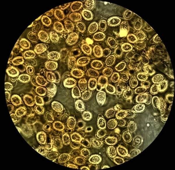 Mushroom Spores under microscope